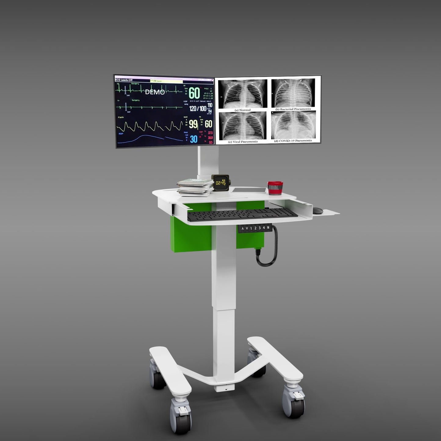 MHS3 Diagnostic Imaging Cart