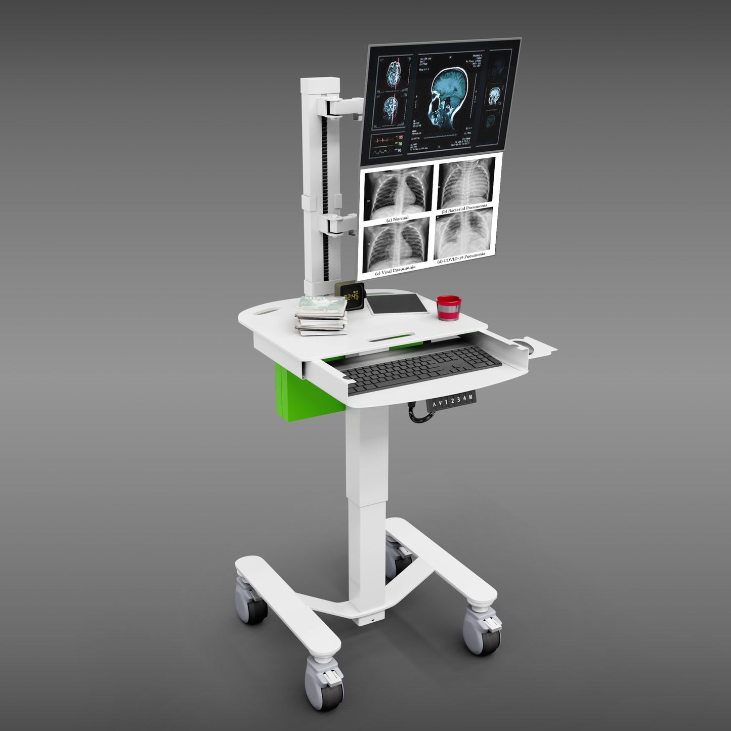 MHS4 Advanced Patient Monitor Cart